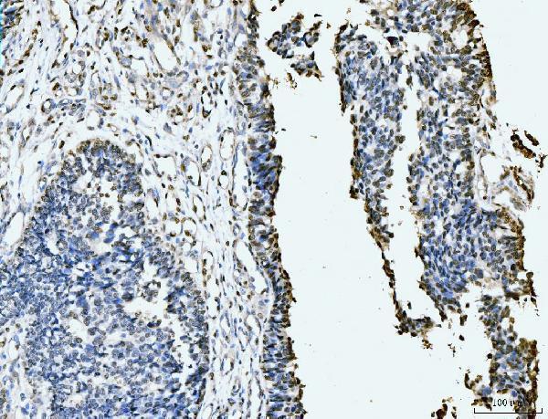 m02755 1 mcm6 primary antibodies ihc testing 4