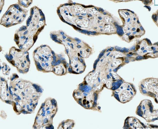 m02755 1 mcm6 primary antibodies ihc testing 5