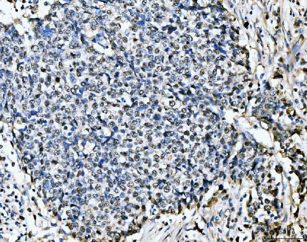 m02755 1 mcm6 primary antibodies ihc testing 6