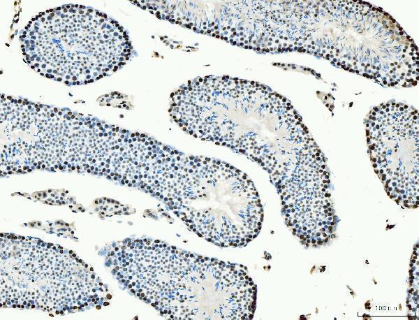 m02755 1 mcm6 primary antibodies ihc testing 7