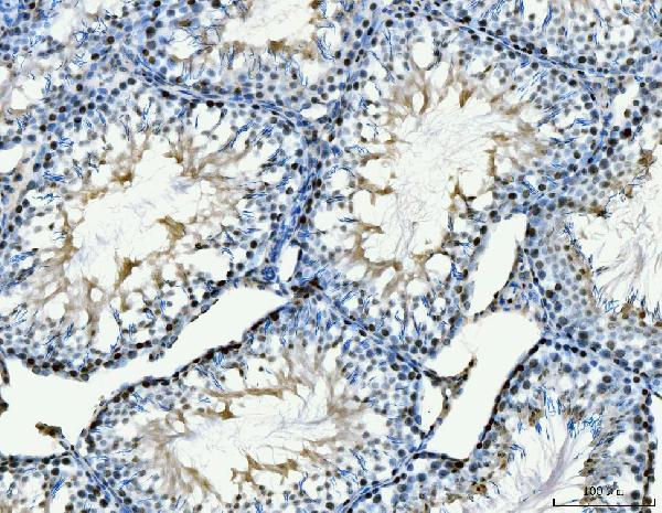 m02755 1 mcm6 primary antibodies ihc testing 8