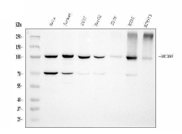  Western blot analysis of MCM6 using anti-MCM6 antibody (M02755-1)