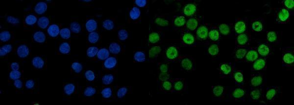 m02755 2 mcm6 primary antibodies if testing 10