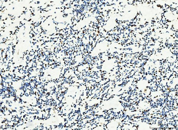  IHC analysis of MCM6 using anti-MCM6 antibody (M02755-2)