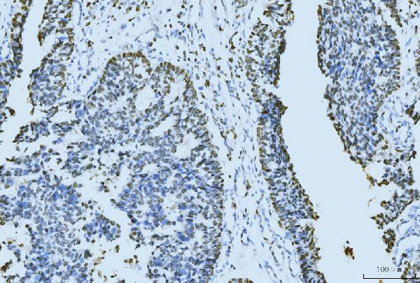  IHC analysis of MCM6 using anti-MCM6 antibody (M02755-2)