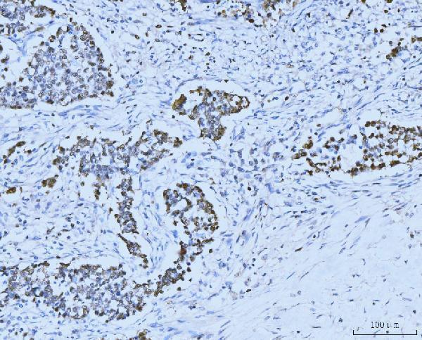 m02755 2 mcm6 primary antibodies ihc testing 5