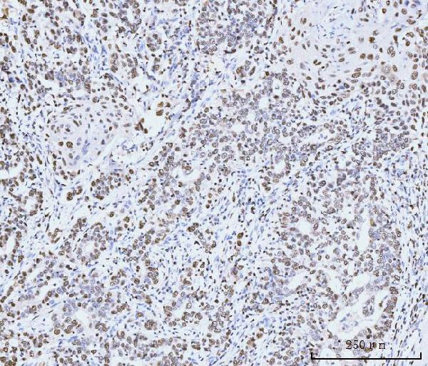 m02755 2 mcm6 primary antibodies ihc testing 6