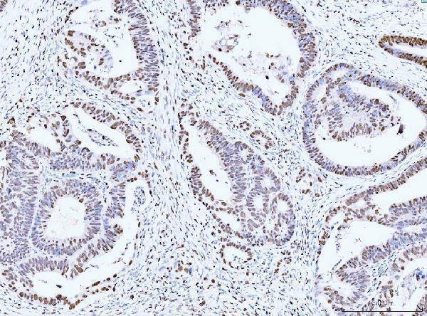 m02755 2 mcm6 primary antibodies ihc testing 7