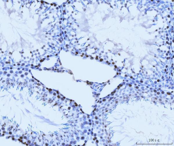 m02755 2 mcm6 primary antibodies ihc testing 9