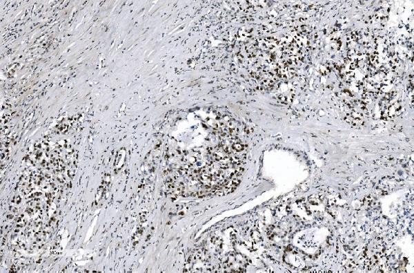m02755 mcm6 primary antibodies ihc testing 2