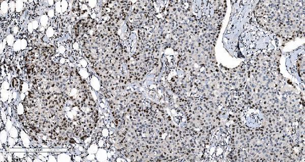 m02755 mcm6 primary antibodies ihc testing 3