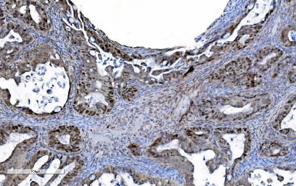 m02755 mcm6 primary antibodies ihc testing 4