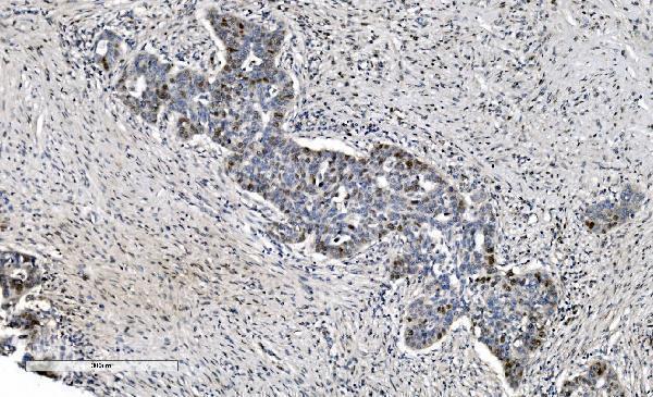 m02755 mcm6 primary antibodies ihc testing 5