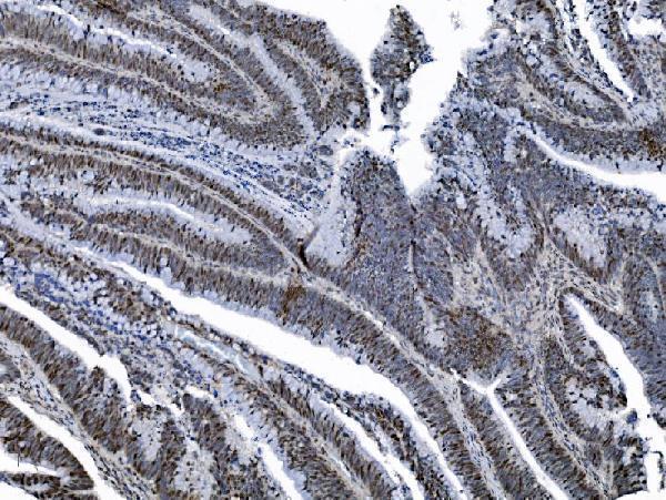 m02755 mcm6 primary antibodies ihc testing 6