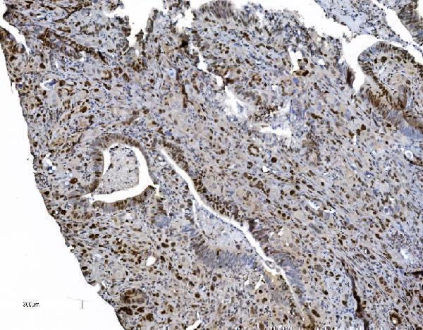 m02755 mcm6 primary antibodies ihc testing 7