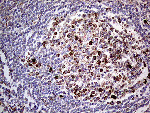 Immunohistochemical staining of paraffin-embedded Human lymph node tissue within the normal limits using anti-TGFBR3 mouse monoclonal antibody