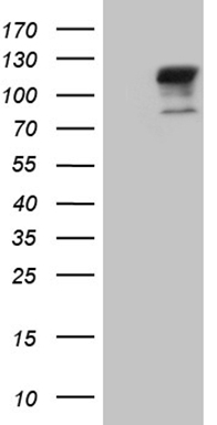HEK293T cells were transfected with the pCMV6-ENTRY control (Left lane) or pCMV6-ENTRY TGFBR3 (Right lane) cDNA for 48 hrs and lysed