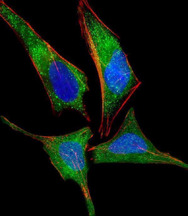 m02768 1 anti nmi antibody if testing 1