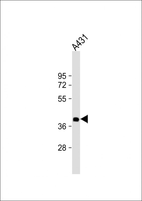 m02768 1 anti nmi antibody wb testing 2