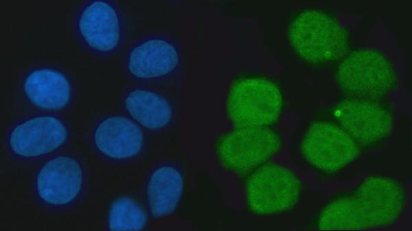 m02770 3 khsrp primary antibodies if testing 2