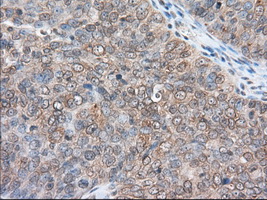 m02771 anti rangap1 mouse monoclonal antibody clone id oti1b4 ihc testing 5