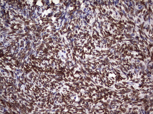 Immunohistochemical staining of paraffin-embedded Human Ovary tissue within the normal limits using anti-CSNK1E mouse monoclonal antibody. (Heat-induced epitope retrieval by 1 mM EDTA in 10mM Tris