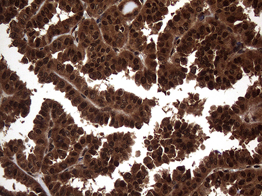 m02777 anti translin tsn mouse monoclonal antibody clone id oti1b5 ihc testing 4