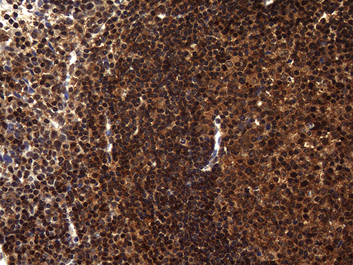 m02777 anti translin tsn mouse monoclonal antibody clone id oti1b5 ihc testing 5