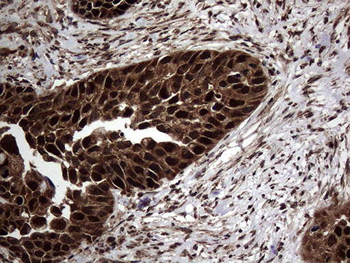m02777 anti translin tsn mouse monoclonal antibody clone id oti1b5 ihc testing 6