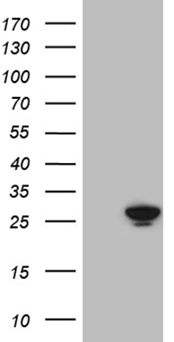 HEK293T cells were transfected with the pCMV6-ENTRY control (Left lane) or pCMV6-ENTRY TSN (Right lane) cDNA for 48 hrs and lysed