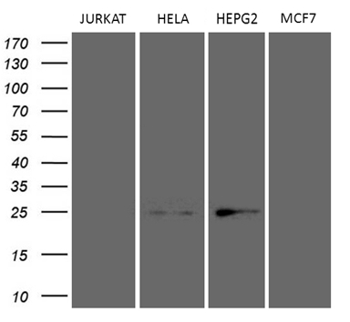 Western blot analysis of extracts (35ug) from 3 different cell lines by using anti-TSN monoclonal antibody (HepG2: human; HeLa: human; Jurkat: human; MCF7: human) (1:500)