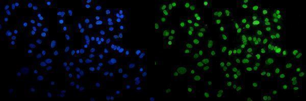 m02780 2 cbx5 primary antibodies if testing 11
