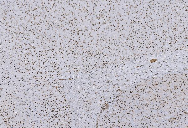  IHC analysis of HP1 alpha/CBX5 using anti-HP1 alpha/CBX5 antibody (M02780-2)