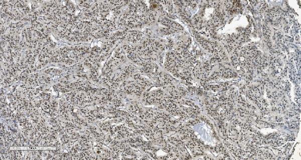  IHC analysis of HP1 alpha/CBX5 using anti-HP1 alpha/CBX5 antibody (M02780-2)
