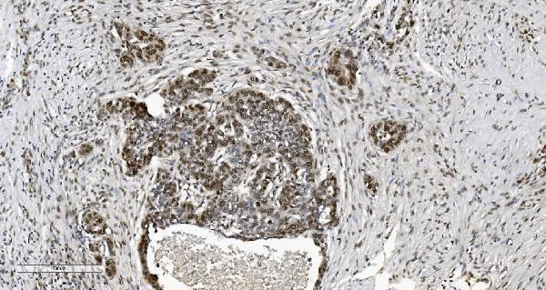 m02780 2 cbx5 primary antibodies ihc testing 3