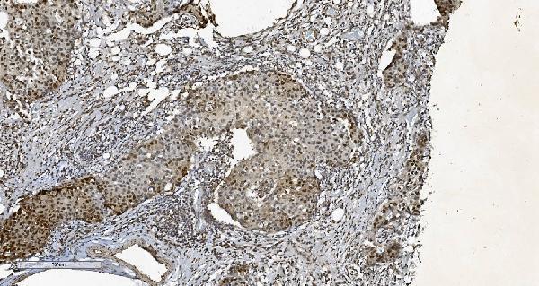 m02780 2 cbx5 primary antibodies ihc testing 4