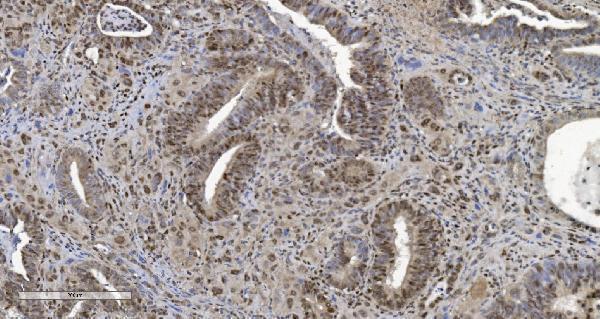 m02780 2 cbx5 primary antibodies ihc testing 5