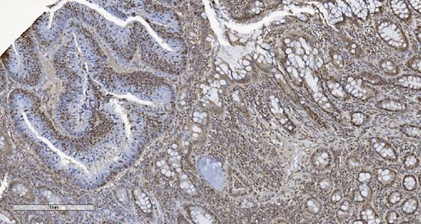 m02780 2 cbx5 primary antibodies ihc testing 7