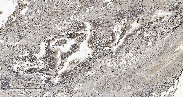 m02780 2 cbx5 primary antibodies ihc testing 8