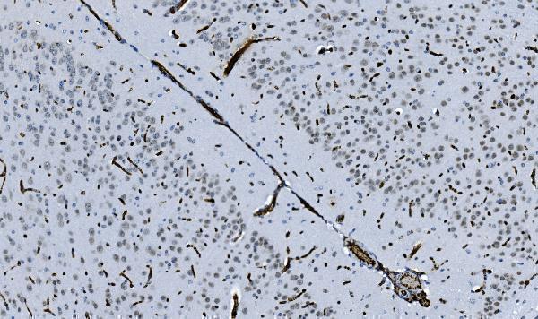 m02780 2 cbx5 primary antibodies ihc testing 9