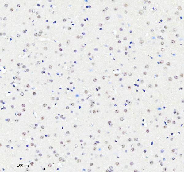m02780 cbx5 primary antibodies ihc testing 2