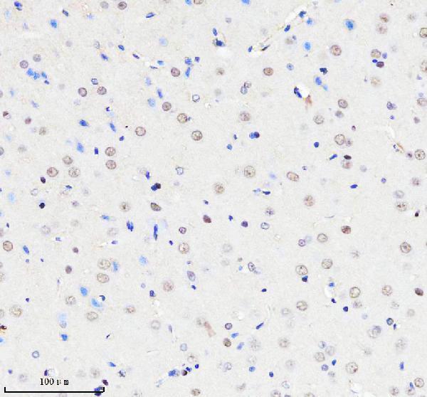 m02780 cbx5 primary antibodies ihc testing 3