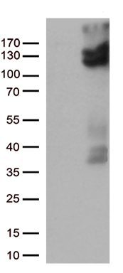 HEK293T cells were transfected with the pCMV6-ENTRY control (Left lane) or pCMV6-ENTRY TRPV2 (Right lane) cDNA for 48 hrs and lysed