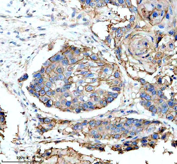 IHC analysis of S100A10 using anti-S100A10 antibody (M02787)