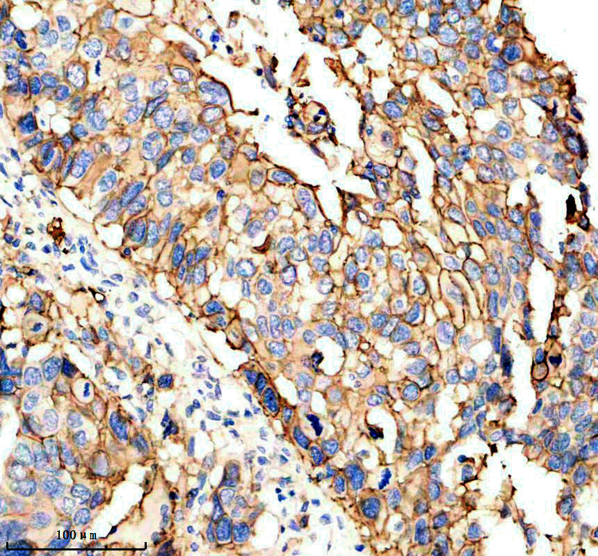 IHC analysis of S100A10 using anti-S100A10 antibody (M02787)
