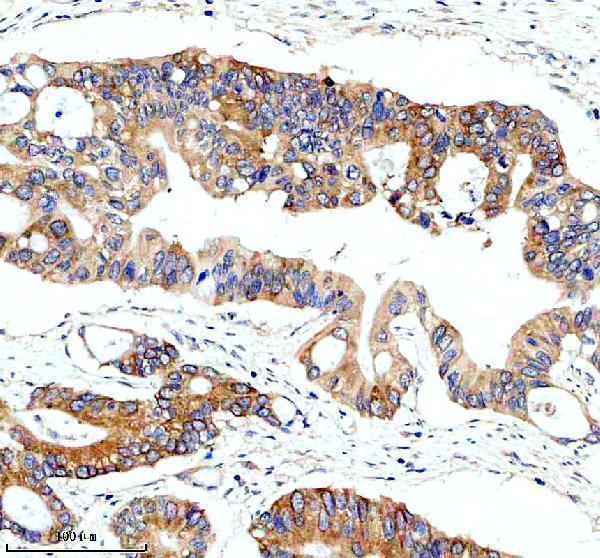 m02791 1 pa2g4 primary antibodies ihc testing 1