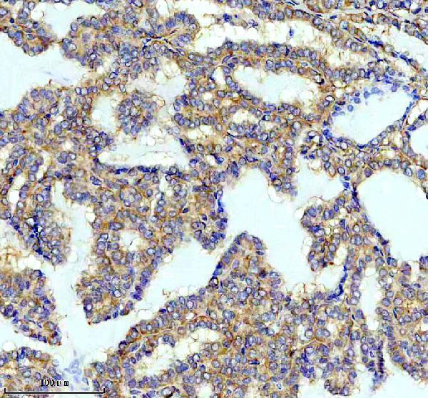 m02791 1 pa2g4 primary antibodies ihc testing 2