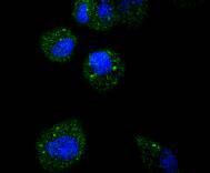m02792 atf5 primary antibodies if testing 3
