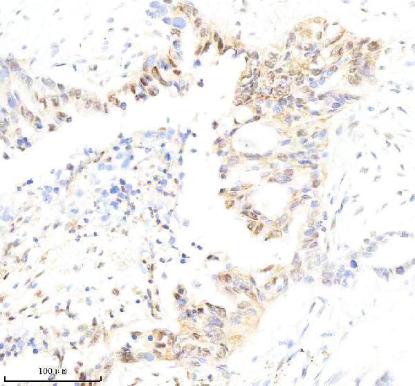  IHC analysis of ATF5 using anti-ATF5 antibody (M02792)