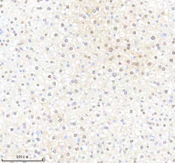  IHC analysis of ATF5 using anti-ATF5 antibody (M02792)
